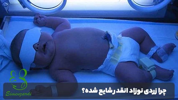 اجاره دستگاه زردی نوزاد در شهر رشت